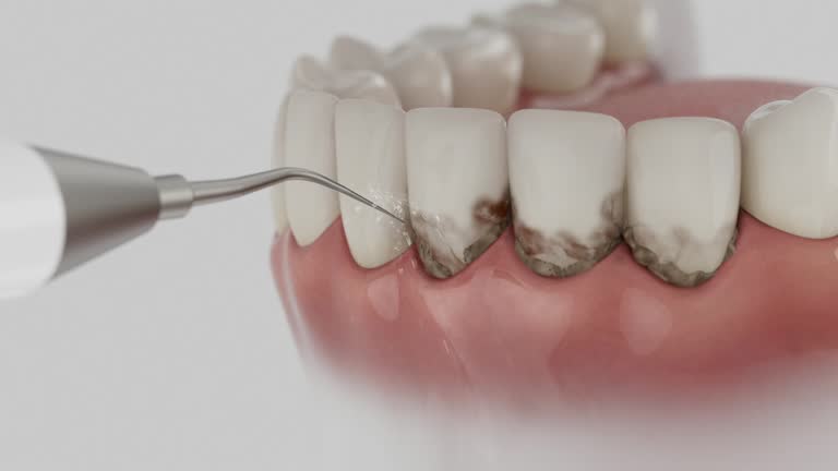 Reliable Dental Implants contractor in Bluefield, VA by Smile Center Dentistry